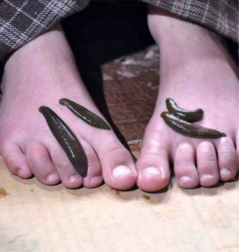 ACU - PLANET Acupuncture & Cupping Therapy Centre A.R Nagar